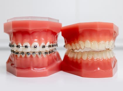 Braces and Orthodontics