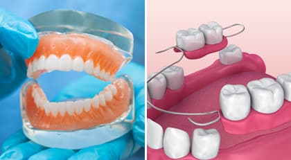 Dentures and Bridges
